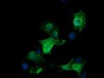 RAB30 Antibody in Immunocytochemistry (ICC/IF)