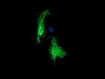 RAB30 Antibody in Immunocytochemistry (ICC/IF)