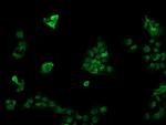 RAB30 Antibody in Immunocytochemistry (ICC/IF)