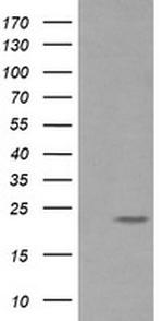 RAB30 Antibody in Western Blot (WB)