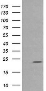 RAB30 Antibody in Western Blot (WB)