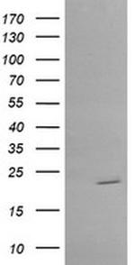 RAB30 Antibody in Western Blot (WB)