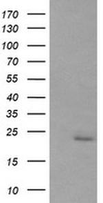 RAB30 Antibody in Western Blot (WB)