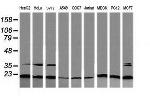 RAB30 Antibody in Western Blot (WB)