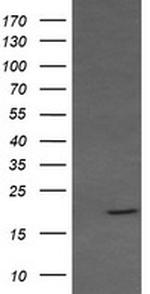 RAB30 Antibody in Western Blot (WB)