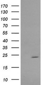 RAB30 Antibody in Western Blot (WB)