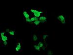 RAB37 Antibody in Immunocytochemistry (ICC/IF)