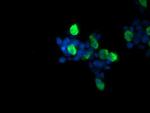 RAB37 Antibody in Immunocytochemistry (ICC/IF)