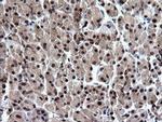 RAB37 Antibody in Immunohistochemistry (Paraffin) (IHC (P))