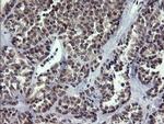 RAB37 Antibody in Immunohistochemistry (Paraffin) (IHC (P))