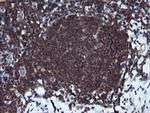 RAB37 Antibody in Immunohistochemistry (Paraffin) (IHC (P))