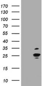 RAB37 Antibody in Western Blot (WB)