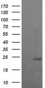 RAB37 Antibody in Western Blot (WB)