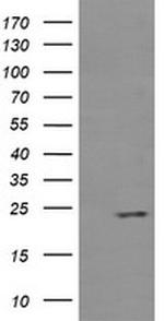 RAB37 Antibody in Western Blot (WB)