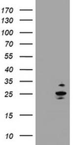 RAB37 Antibody in Western Blot (WB)