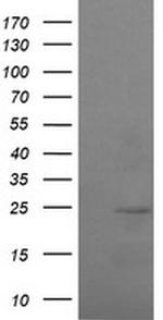 RAB37 Antibody in Western Blot (WB)