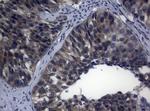 RAB3A Antibody in Immunohistochemistry (Paraffin) (IHC (P))