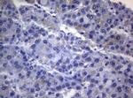 RAB3A Antibody in Immunohistochemistry (Paraffin) (IHC (P))