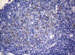 RAB3A Antibody in Immunohistochemistry (Paraffin) (IHC (P))