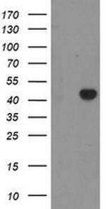 RAB3IL1 Antibody in Western Blot (WB)