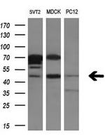 RAB3IL1 Antibody in Western Blot (WB)