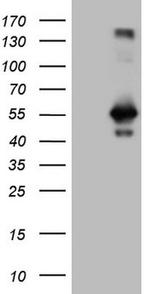 RAB3IP Antibody in Western Blot (WB)