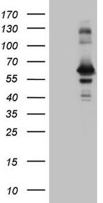 RAB3IP Antibody in Western Blot (WB)