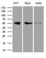 RAB3IP Antibody in Western Blot (WB)