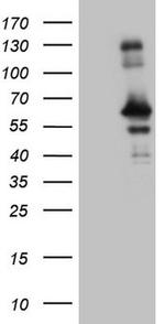 RAB3IP Antibody in Western Blot (WB)