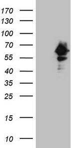 RAB3IP Antibody in Western Blot (WB)