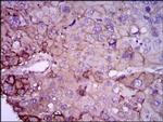 Rab4 Antibody in Immunohistochemistry (Paraffin) (IHC (P))