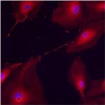 RAB5 Antibody in Immunocytochemistry (ICC/IF)