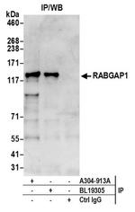 RABGAP1 Antibody in Immunoprecipitation (IP)