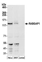 RABGAP1 Antibody in Western Blot (WB)