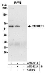 RABGEF1 Antibody in Immunoprecipitation (IP)