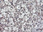 RABL2A Antibody in Immunohistochemistry (Paraffin) (IHC (P))