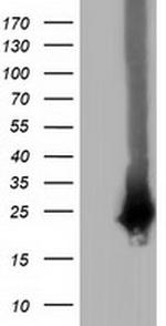 RABL2A Antibody in Western Blot (WB)