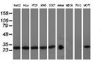 RABL2A Antibody in Western Blot (WB)