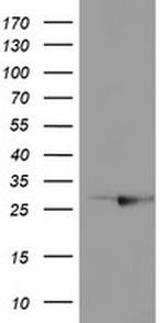 RABL2A Antibody in Western Blot (WB)