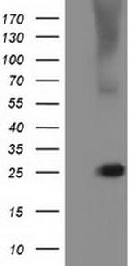 RABL2A Antibody in Western Blot (WB)