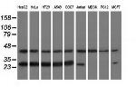 RABL2A Antibody in Western Blot (WB)