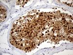 RACGAP1 Antibody in Immunohistochemistry (Paraffin) (IHC (P))