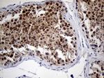 RACGAP1 Antibody in Immunohistochemistry (Paraffin) (IHC (P))