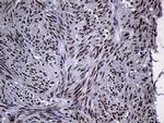 RACGAP1 Antibody in Immunohistochemistry (Paraffin) (IHC (P))