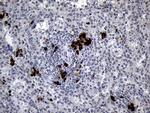 RACGAP1 Antibody in Immunohistochemistry (Paraffin) (IHC (P))