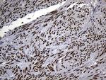 RACGAP1 Antibody in Immunohistochemistry (Paraffin) (IHC (P))