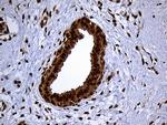 RAD21 Antibody in Immunohistochemistry (Paraffin) (IHC (P))