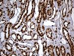 RAD21 Antibody in Immunohistochemistry (Paraffin) (IHC (P))