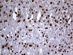 RAD21 Antibody in Immunohistochemistry (Paraffin) (IHC (P))