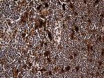 RAD21 Antibody in Immunohistochemistry (Paraffin) (IHC (P))